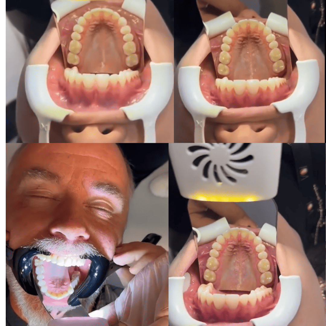 Espejo bucal antivaho para fotografía Uclanu