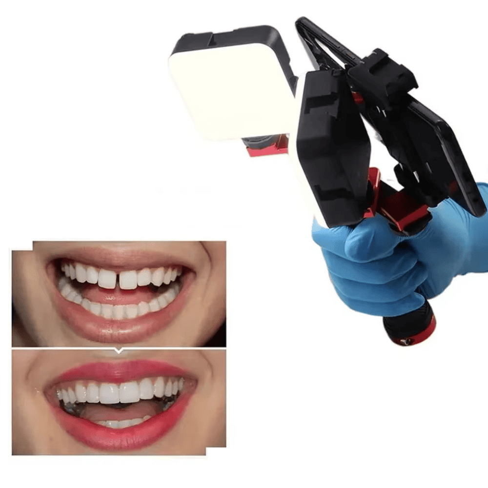 LED Topflash para Fotografía Dental con Teléfono Celular